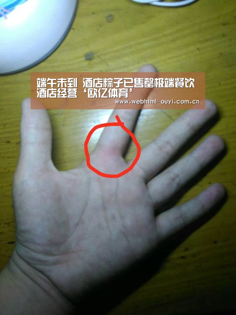 端午未到 酒店粽子已售罄极端餐饮酒店经营‘欧亿体育’(图2) 欧亿体育集团